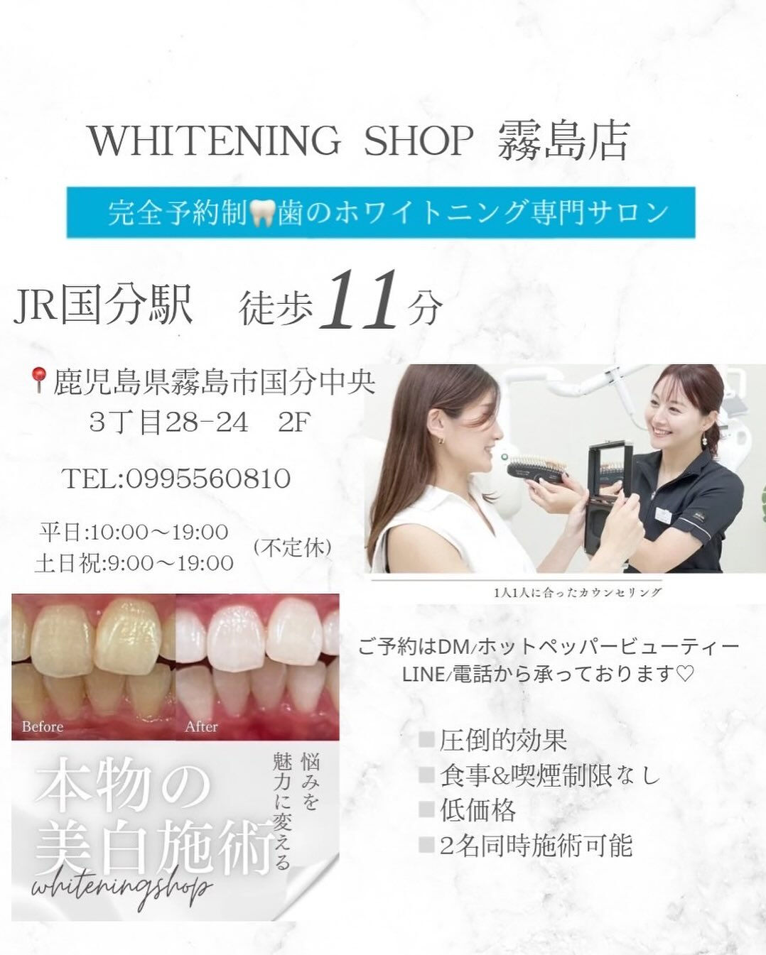 ✨【霧島市で話題のセルフホワイトニング】✨